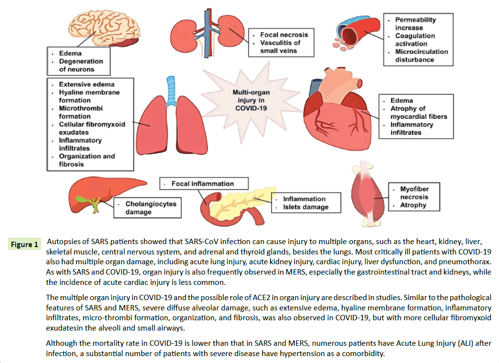 neoplasm-multiple-organs