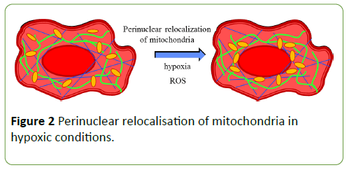 neoplasm-Perinuclear-relocalisation-mitochondria